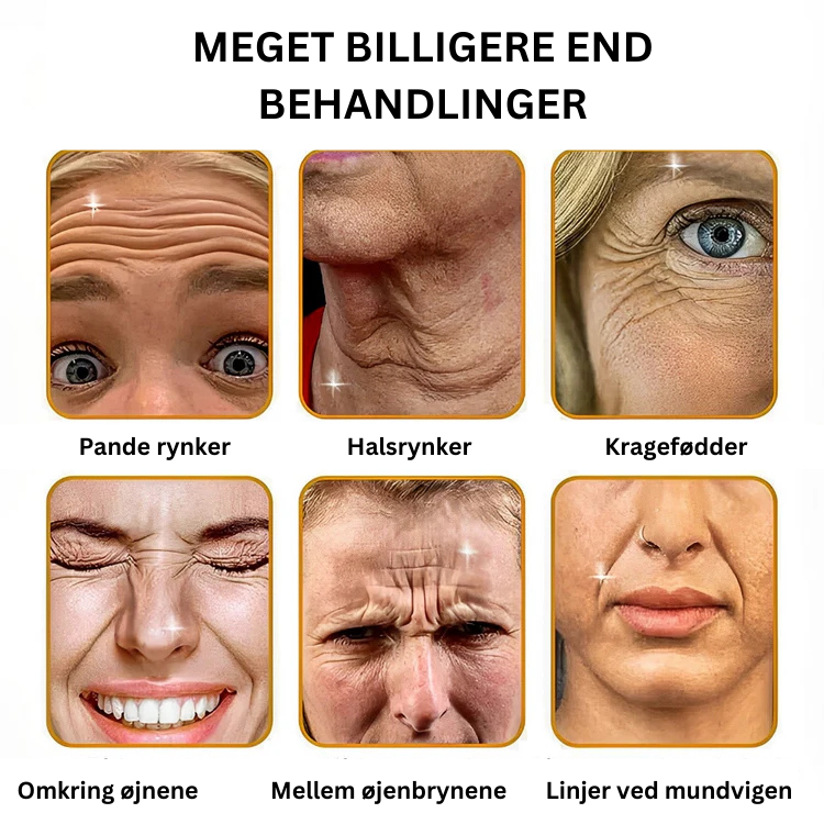"BOTOX™ Anti-rynke creme"