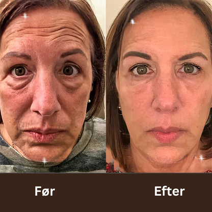 "BOTOX™ Anti-rynke creme"