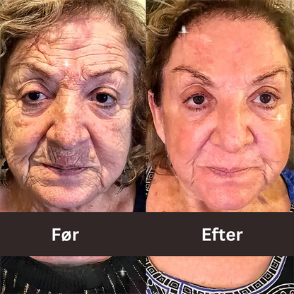 "BOTOX™ Anti-rynke creme"