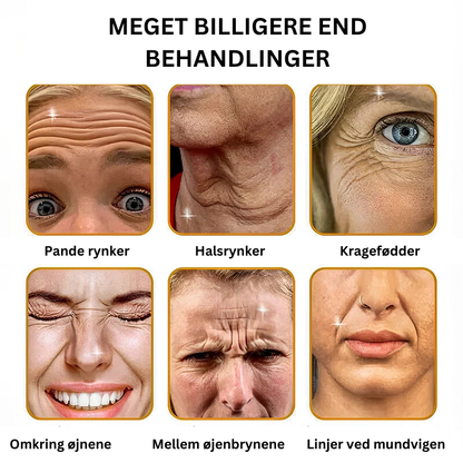"BOTOX™ Anti-rynke creme"